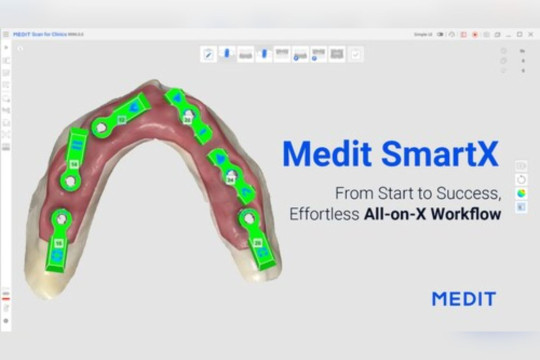 Terobosan "All-on-X": Solusi Alur Kerja Medit yang Inovatif Segera Diluncurkan